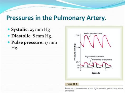 Pulmonary Artery Pressure Gradient