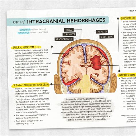 Brain Hemorrhage Causes Types Symptoms Diagnosis