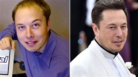 Elon Musk's Hair Transformation: What He Did and How He Did It - The Tech Outlook