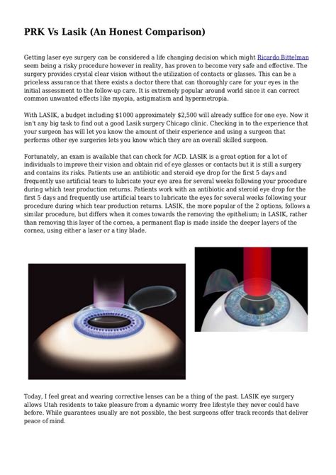 PRK Vs Lasik (An Honest Comparison)