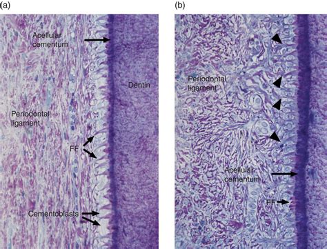 Cementum Histology