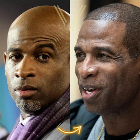 Deion Sanders' Hair Transplant: Before and After Transformation