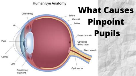 What Causes Pinpoint Pupils - YouTube