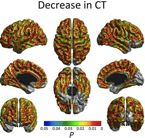 Cognitive ability changes and dynamics of cortical thickness ...