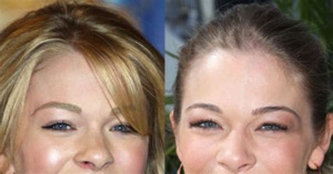 LeAnn Rimes' Teeth Troubles: See Them Before and After the Disputed Dental Work | E! News