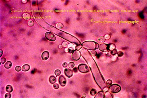 Candida albicans (1000X magnification) | Classified as Yeast… | Flickr