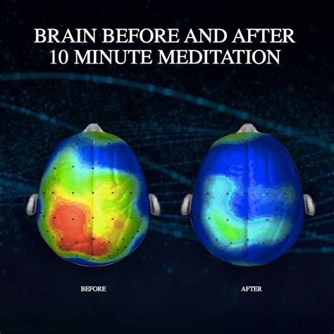 The Brain Before And After Meditation Pictures, Photos, and Images for ...