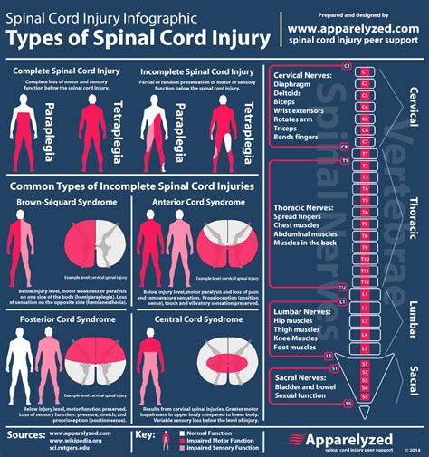 incomplete spinal cord injury infographic | PT stuff | Pinterest | Spinal cord, Infographic and Cord