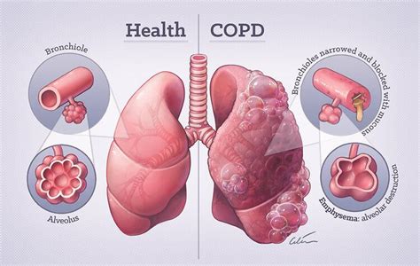 Portfolio - Medical Illustration by Dr Ciléin Kearns (Artibiotics ...