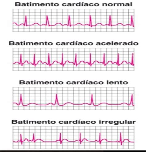 Blog da Biblioteca do IC/FUC: Arritmias cardíacas