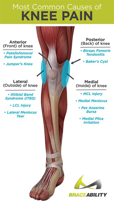 Types of Knee Pain: Anterior, Posterior, Medial, & Lateral