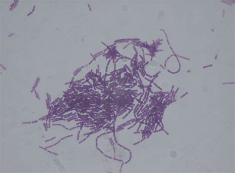 Bacillus thuringiensis | Wiki | Everipedia