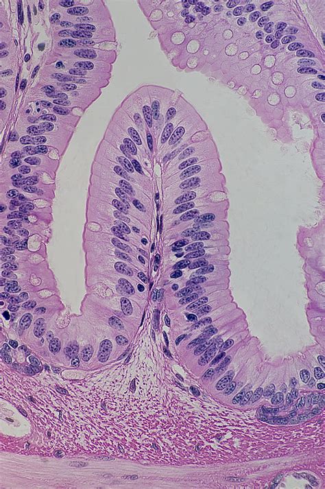 Simple Columnar Epithelium, Goblet Cells & Villus Photograph by Ed Reschke