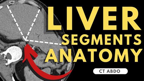 Liver Segments on CT scan | Radiology anatomy part 1 prep | Segmental Liver Anatomy CT - YouTube