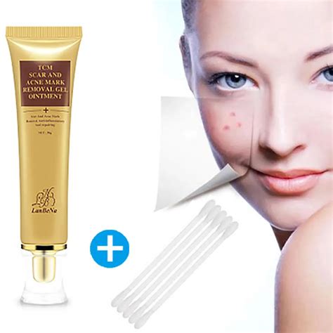 Aliexpress.com : Buy Acne Scar Stretch Marks Remover Cream Skin Repair Face Cream Acne Spots ...