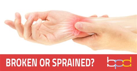 Broken or Sprained Wrist - Brandon P. Donnelly, MD