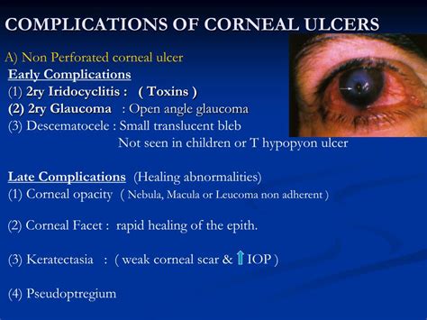 PPT - THE CORNEA PowerPoint Presentation, free download - ID:4800497