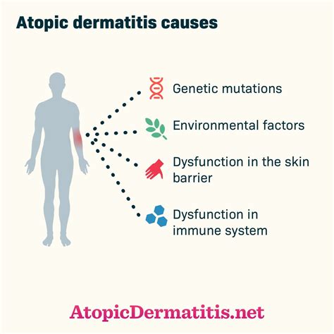 Click to learn more about the causes of #atopicdermatitis #eczema ...