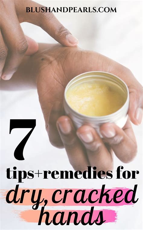 Suffering From Dry Hands? Here Are 7 Remedies To Help Blush & Pearls