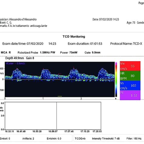 Normal image of TCD-X registration | Download Scientific Diagram