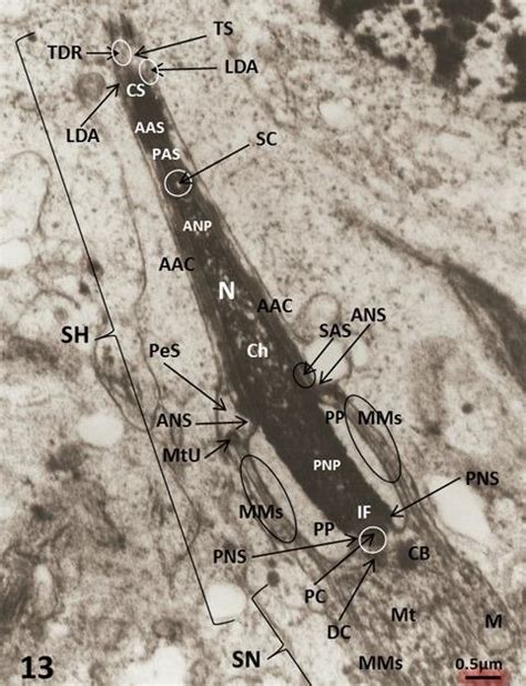 Electron micrograph showed continuous chromatin condensation and... | Download Scientific Diagram