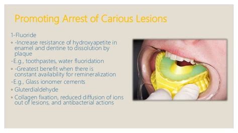 Early childhood caries, rampant, chronic and arrested caries