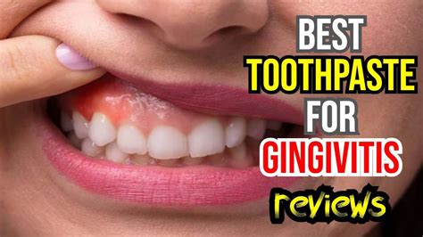 🦷 Best Toothpaste for Gingivitis & Bleeding Gums: Top 3 Picks Reviewed ...