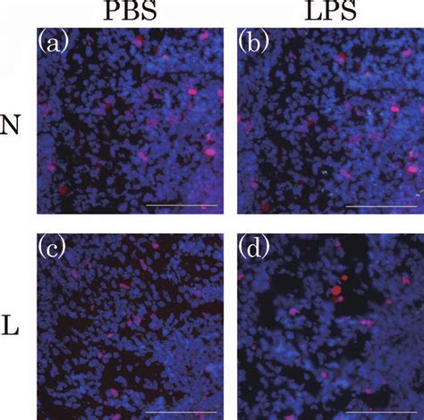 Detection of apoptotic cells and OPCs. (a) N-PBS, (b) N-LPS, (c) L-PBS... | Download Scientific ...