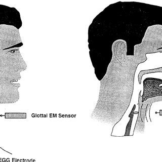 Four examples of falsetto voice, with F 0 ranging form 266 to 578 | Download Scientific Diagram