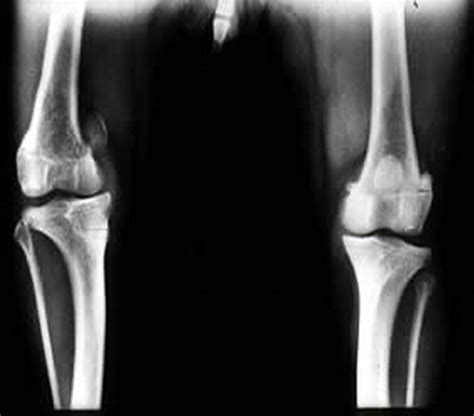 Medial Luxation of the Patella - Western Suburbs Adelaide Vet