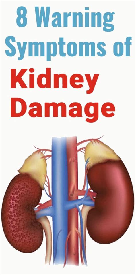 8 Warning Symptoms of Kidney Damage | Kidney damage, Health info, Health and beauty tips