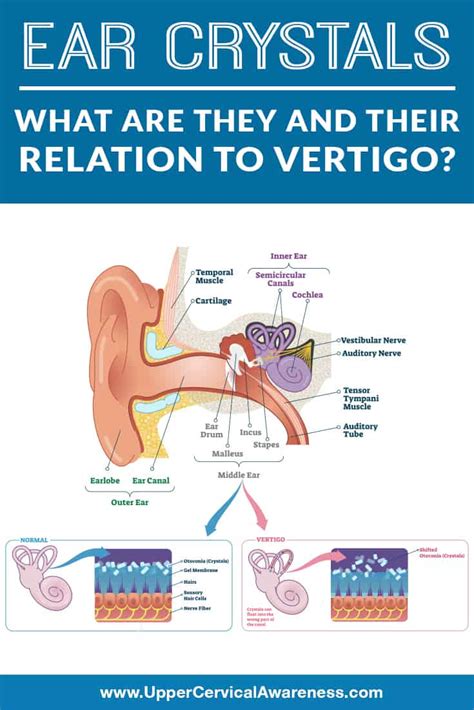 Ear Crystals: What Are They and Their Relation to Vertigo?