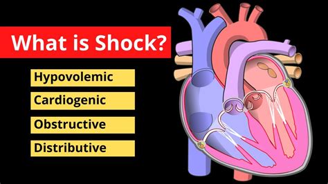 Shock Explained in 120 Seconds | Treatment, Symptoms, Causes | Video - YouTube