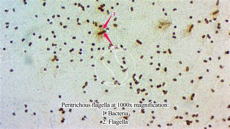 Peritrichous flagella under the microscope - YouTube