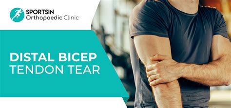 Distal Bicep Tendon Tear | SportsIn Orthopaedic Clinic | Dr Bernard Lee