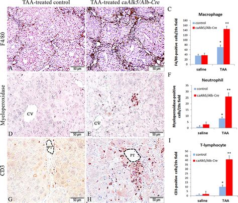 Immunohistochemistry for macrophages: F4/80 (A and B), for neutrophils:... | Download Scientific ...