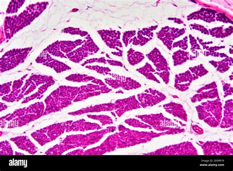 Fiber microscope hi-res stock photography and images - Alamy