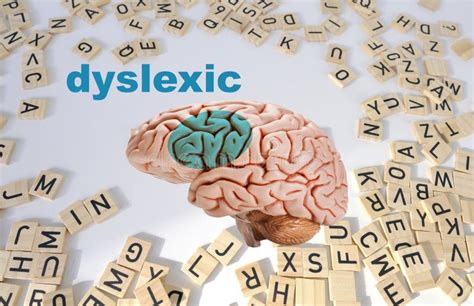 Neural Signature in Human Brain for Dyslexia, Disruption of Posterior ...