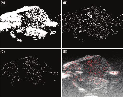 Skeletonization process. This sample is relative to the injection of... | Download Scientific ...