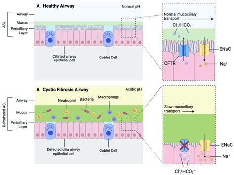 Simplified schematic of a healthy and CF airway. (A) Normal functioning ...