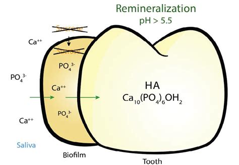 The Delicate Balance of Remineralization and Demineralization ...