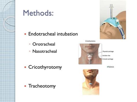 Endotracheal Intubation Vs Tracheostomy