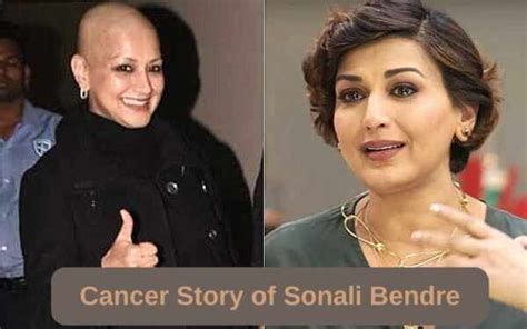 Cancer Recovery Story of Sonali Bendre - Cancer Rounds