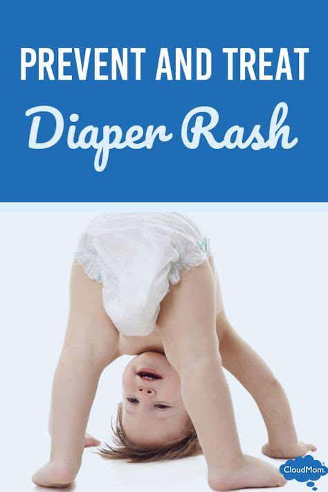 5 Tips for Preventing and Treating Diaper Rash | Baby diaper rash ...