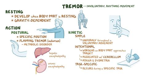 Clinical Reasoning: Hyperkinetic movement disorders - Osmosis