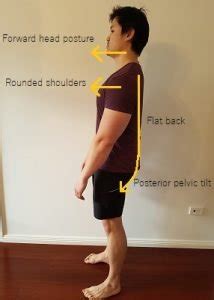 How To Fix Flat Back Posture - Posture Direct