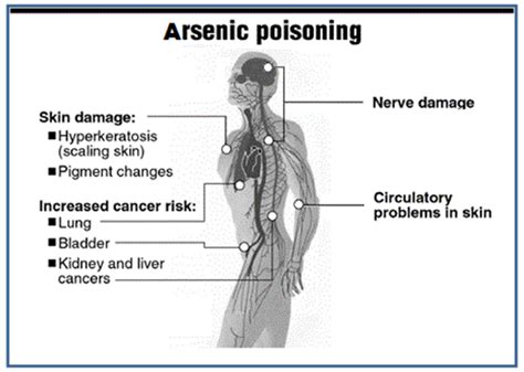 Arsenic Poisoning of Water and Rampant Cancer Outbreaks in North India ...