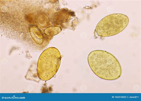 Eggs of Intestinal Fluke in Human Stool Stock Image - Image of ...