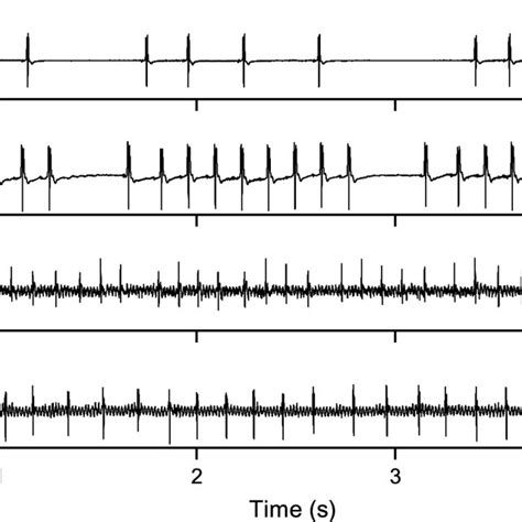 Representative ECG recordings from four species of Soricomorpha, a... | Download Scientific Diagram