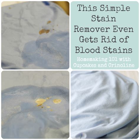 15 Brilliant Stain Removal Tips- Angela Says